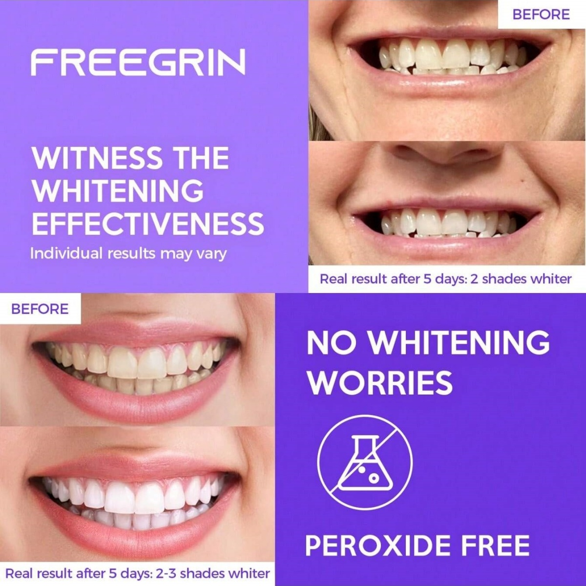 Deluxe Tanden Whitening Sticke - Home Fragrance Gel recensie en prijs